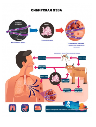 Что такое сибирская язва